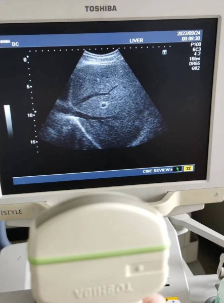 Annonce Des sondes &eacute;chographes neuf et bonne occasion