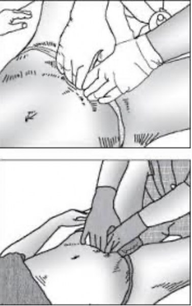 Massage karsai nei tsang bodywork