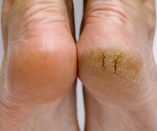 Soins bien &ecirc;tre du pied pour femme